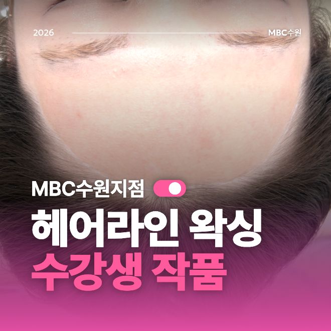 [수원] 헤어라인 왁싱 작품