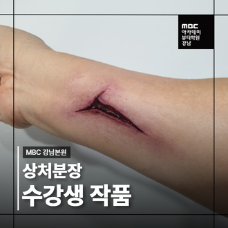 실감나는 상처분장