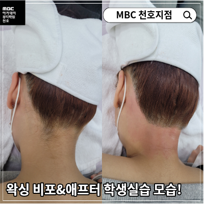 [천호지점]왁싱 비포&애프터 학생실습 모습!